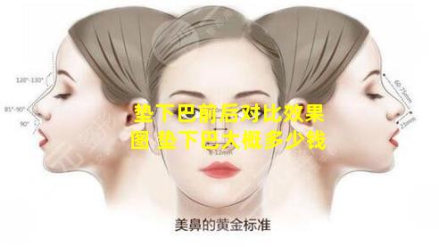 垫下巴前后对比效果图 垫下巴大概多少钱